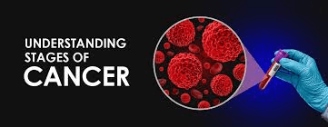 Cancer Patient doing light exercise and morning walk for better health.